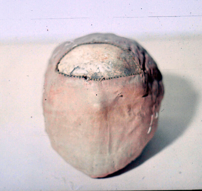 OLYMPUS DIGITAL CAMERA Relikwia głowy okryta średniowiecznymi tkaninami jedwabnymi. Fotografie wykonane podczas konserwacji w latach 80. XX w. po zdjęciu dwóch warstw tkanin